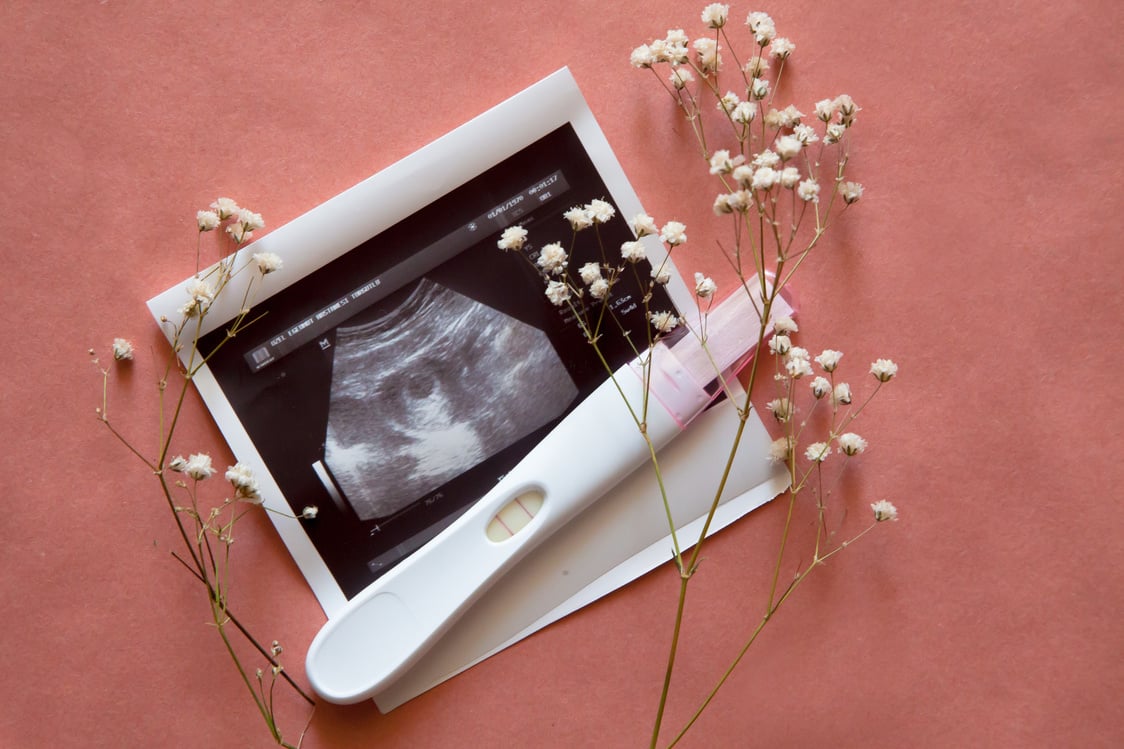 Pregnancy Test Kit, Ultrasound Image, and Flowers Flatlay